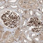 PPM1F Antibody in Immunohistochemistry (Paraffin) (IHC (P))