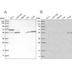 PPM1F Antibody in Western Blot (WB)