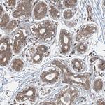 PPM1F Polyclonal Antibody