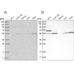 PPM1F Antibody in Western Blot (WB)