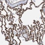 EPS8L3 Antibody in Immunohistochemistry (Paraffin) (IHC (P))