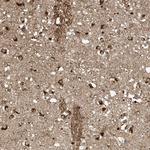 TAGAP Polyclonal Antibody