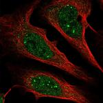 ZCCHC12 Antibody in Immunocytochemistry (ICC/IF)