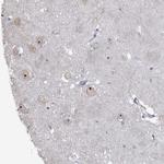 ZCCHC12 Antibody in Immunohistochemistry (Paraffin) (IHC (P))