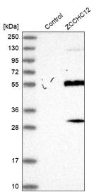 ZCCHC12 Antibody in Western Blot (WB)