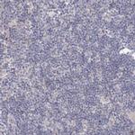 TACC2 Antibody in Immunohistochemistry (IHC)