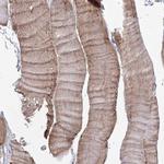 TACC2 Polyclonal Antibody