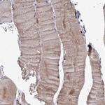 TACC2 Antibody in Immunohistochemistry (IHC)