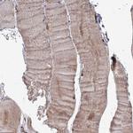 TACC2 Polyclonal Antibody