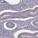 SLC7A4 Antibody in Immunohistochemistry (IHC)