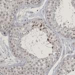 ZNF674 Antibody in Immunohistochemistry (Paraffin) (IHC (P))