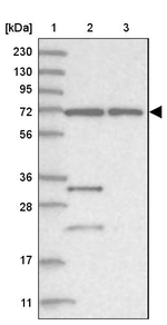 ZNF674 Antibody in Western Blot (WB)