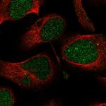 PHF1 Polyclonal Antibody