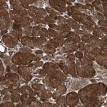 PHF1 Antibody in Immunohistochemistry (Paraffin) (IHC (P))