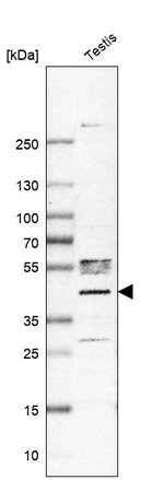 PHF1 Antibody in Western Blot (WB)