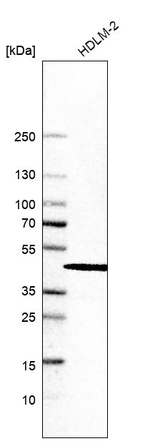 SKIP Antibody in Western Blot (WB)