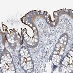 F131C Antibody in Immunohistochemistry (Paraffin) (IHC (P))
