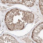 TSNAX Antibody in Immunohistochemistry (Paraffin) (IHC (P))
