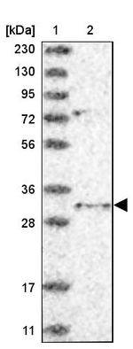 TSNAX Antibody in Western Blot (WB)