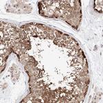 TSNAX Polyclonal Antibody