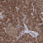 PCID1 Antibody in Immunohistochemistry (Paraffin) (IHC (P))