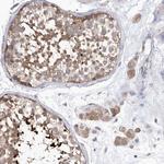 PCID1 Antibody in Immunohistochemistry (Paraffin) (IHC (P))