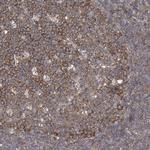 PCID1 Antibody in Immunohistochemistry (Paraffin) (IHC (P))