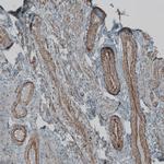 NPR3 Antibody in Immunohistochemistry (IHC)