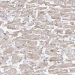 Kir6.1 (KCNJ8) Polyclonal Antibody