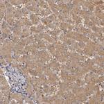 Kir6.1 (KCNJ8) Antibody in Immunohistochemistry (IHC)