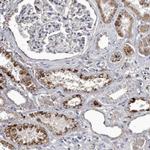 Cathepsin A Antibody in Immunohistochemistry (IHC)