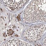 Cathepsin A Antibody in Immunohistochemistry (IHC)