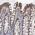 Cathepsin A Antibody in Immunohistochemistry (IHC)