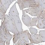 Cathepsin A Antibody in Immunohistochemistry (IHC)