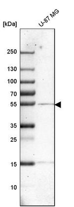 Cathepsin A Antibody in Western Blot (WB)