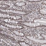 PRUNE2 Polyclonal Antibody