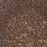 PISD Polyclonal Antibody