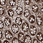 PISD Antibody in Immunohistochemistry (Paraffin) (IHC (P))