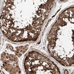 PISD Antibody in Immunohistochemistry (Paraffin) (IHC (P))