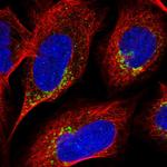 ICB-1 Polyclonal Antibody