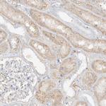 OCSTAMP Antibody in Immunohistochemistry (Paraffin) (IHC (P))