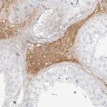OCSTAMP Antibody in Immunohistochemistry (Paraffin) (IHC (P))
