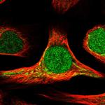 DHRS7 Polyclonal Antibody