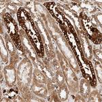DHRS7 Antibody in Immunohistochemistry (Paraffin) (IHC (P))