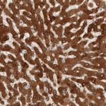 DHRS7 Antibody in Immunohistochemistry (Paraffin) (IHC (P))