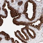 DHRS7 Antibody in Immunohistochemistry (Paraffin) (IHC (P))