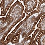 DHRS7 Antibody in Immunohistochemistry (Paraffin) (IHC (P))