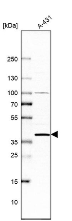 DHRS7 Antibody in Western Blot (WB)