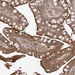 ZNF124 Antibody in Immunohistochemistry (Paraffin) (IHC (P))