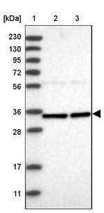 ZNF124 Antibody in Western Blot (WB)